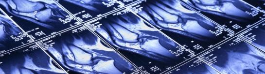 [KCE] Press release : KCE Reports 205 Extremity-only MRI